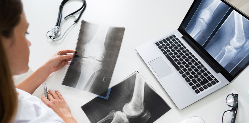 Do I need imaging after an injury?